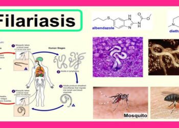 India losing race to filariasis?