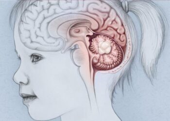 Drug Tovorafeniv may halt/shrink childhood brain tumor: Researchers