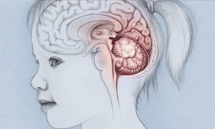 Drug Tovorafeniv may halt/shrink childhood brain tumor: Researchers