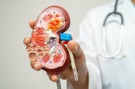 New Drug Offers Hope for Millions Living with CKD without Diabetes