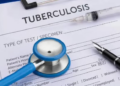 S&T Initiative Boosts TB Detection In Rajasthan