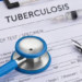 S&T Initiative Boosts TB Detection In Rajasthan