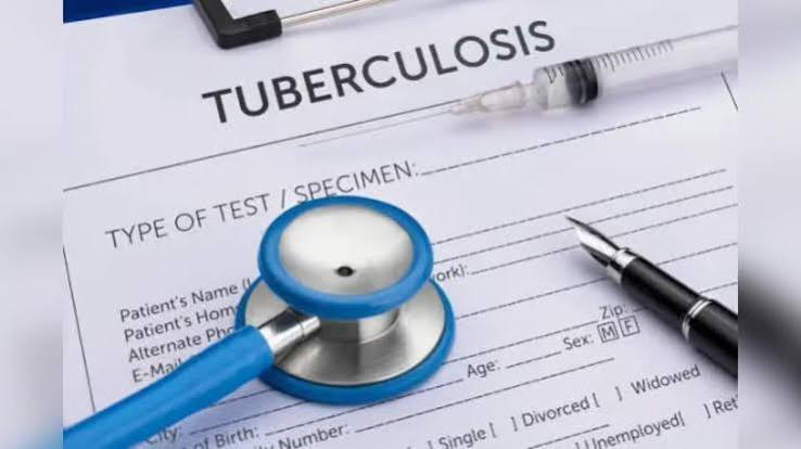 S&T Initiative Boosts TB Detection In Rajasthan